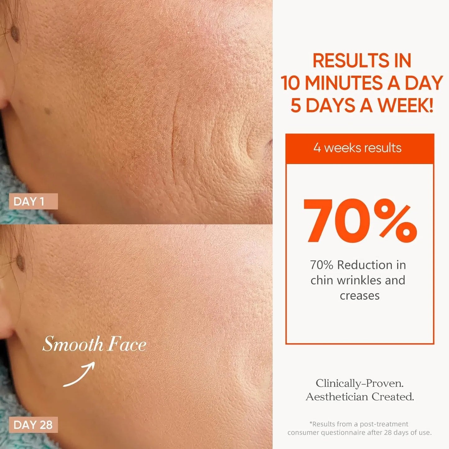 7 Color Cordless LED Face Mask For Wrinkle & Acne Reducing - Black